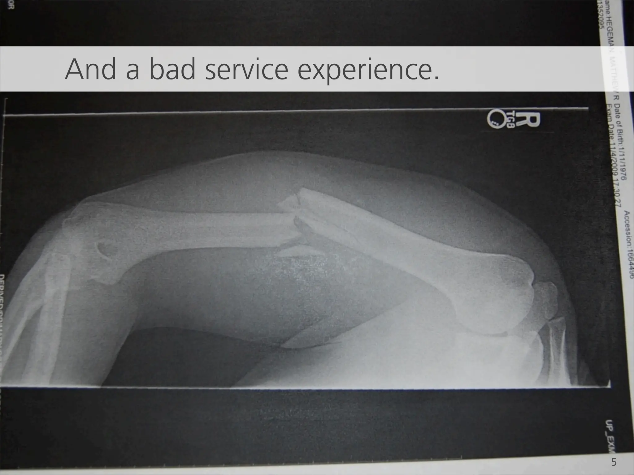 And a bad service experience.




                                5
 