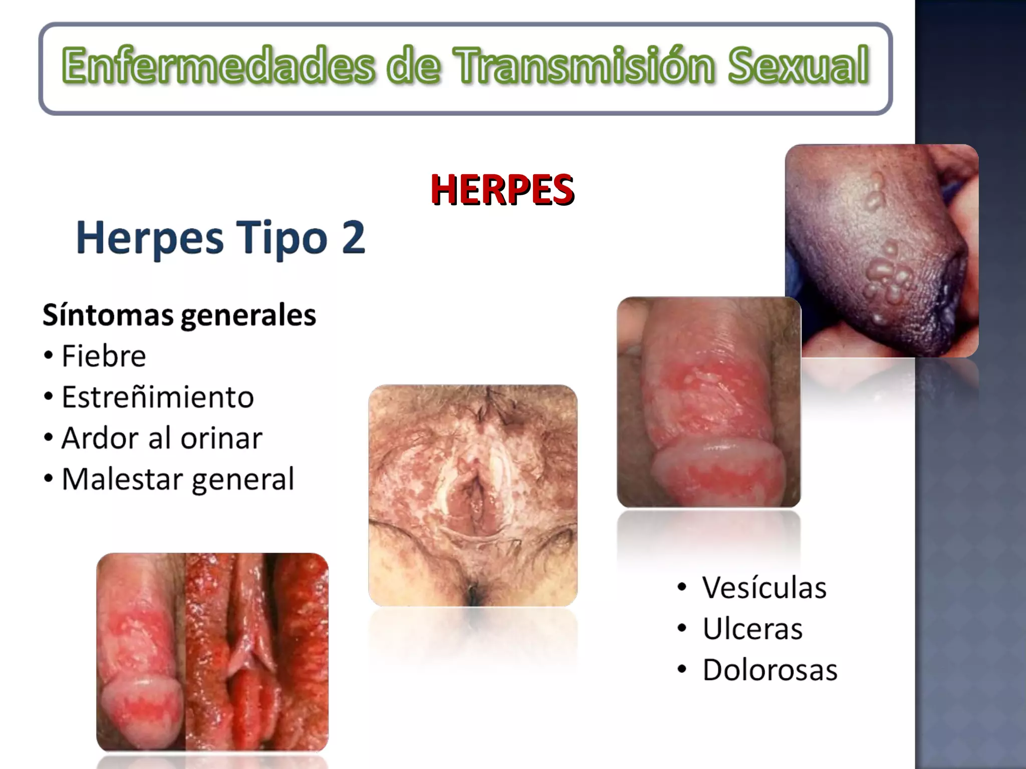 HERPES 