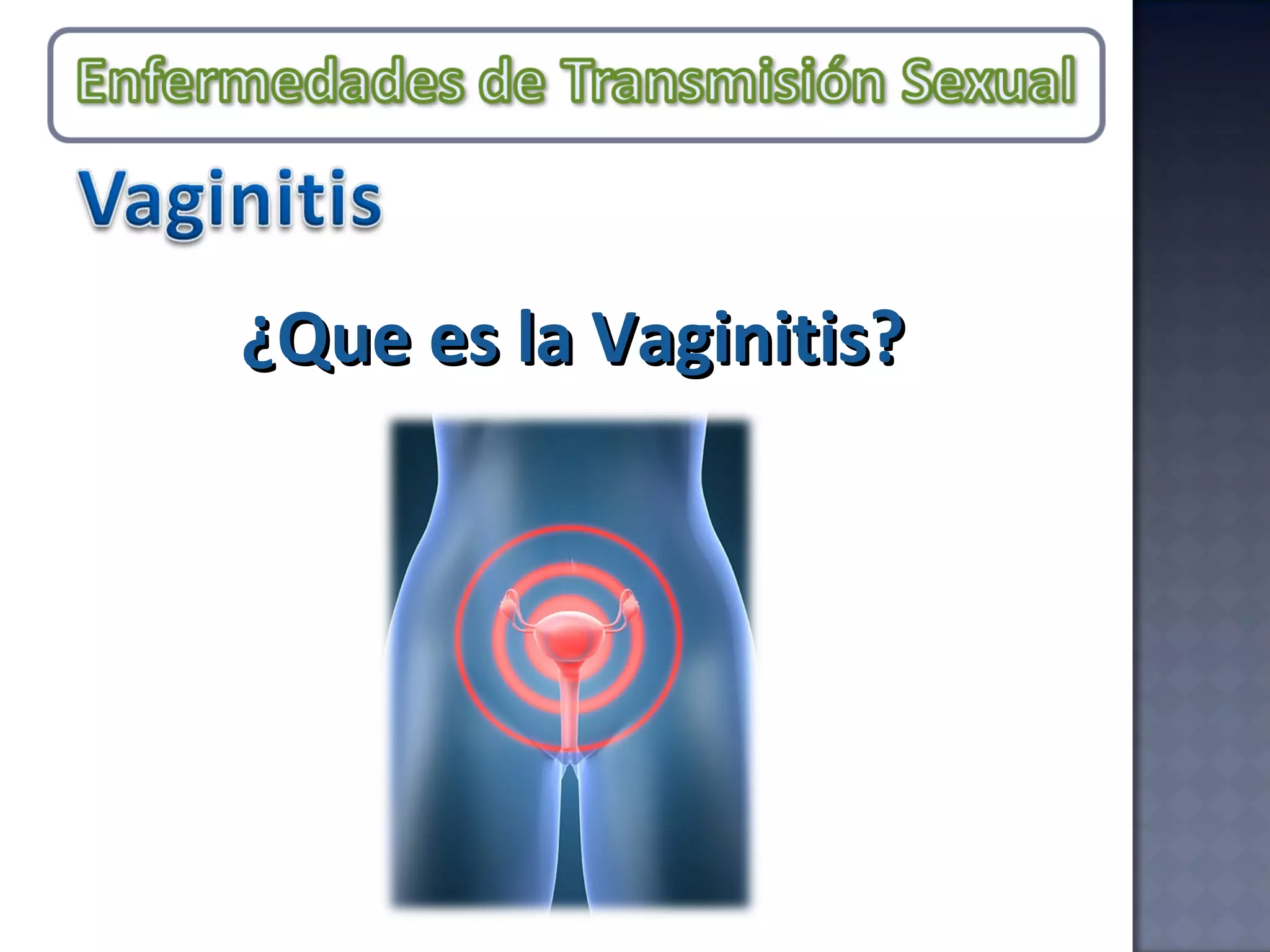¿Que es la Vaginitis? 