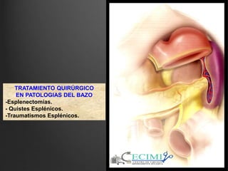 TRATAMIENTO QUIRÚRGICO
EN PATOLOGIAS DEL BAZO
-Esplenectomías.
- Quistes Esplénicos.
-Traumatismos Esplénicos.
 