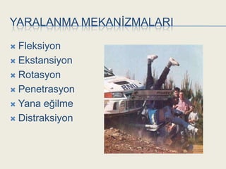 YARALANMA MEKANĠZMALARI

 Fleksiyon
 Ekstansiyon

 Rotasyon

 Penetrasyon

 Yana eğilme

 Distraksiyon
 