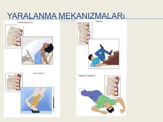 YARALANMA MEKANIZMALARı
 