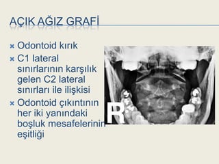 AÇIK AĞIZ GRAFĠ

 Odontoid kırık
 C1 lateral
  sınırlarının karĢılık
  gelen C2 lateral
  sınırları ile iliĢkisi
 Odontoid çıkıntının
  her iki yanındaki
  boĢluk mesafelerinin
  eĢitliği
 