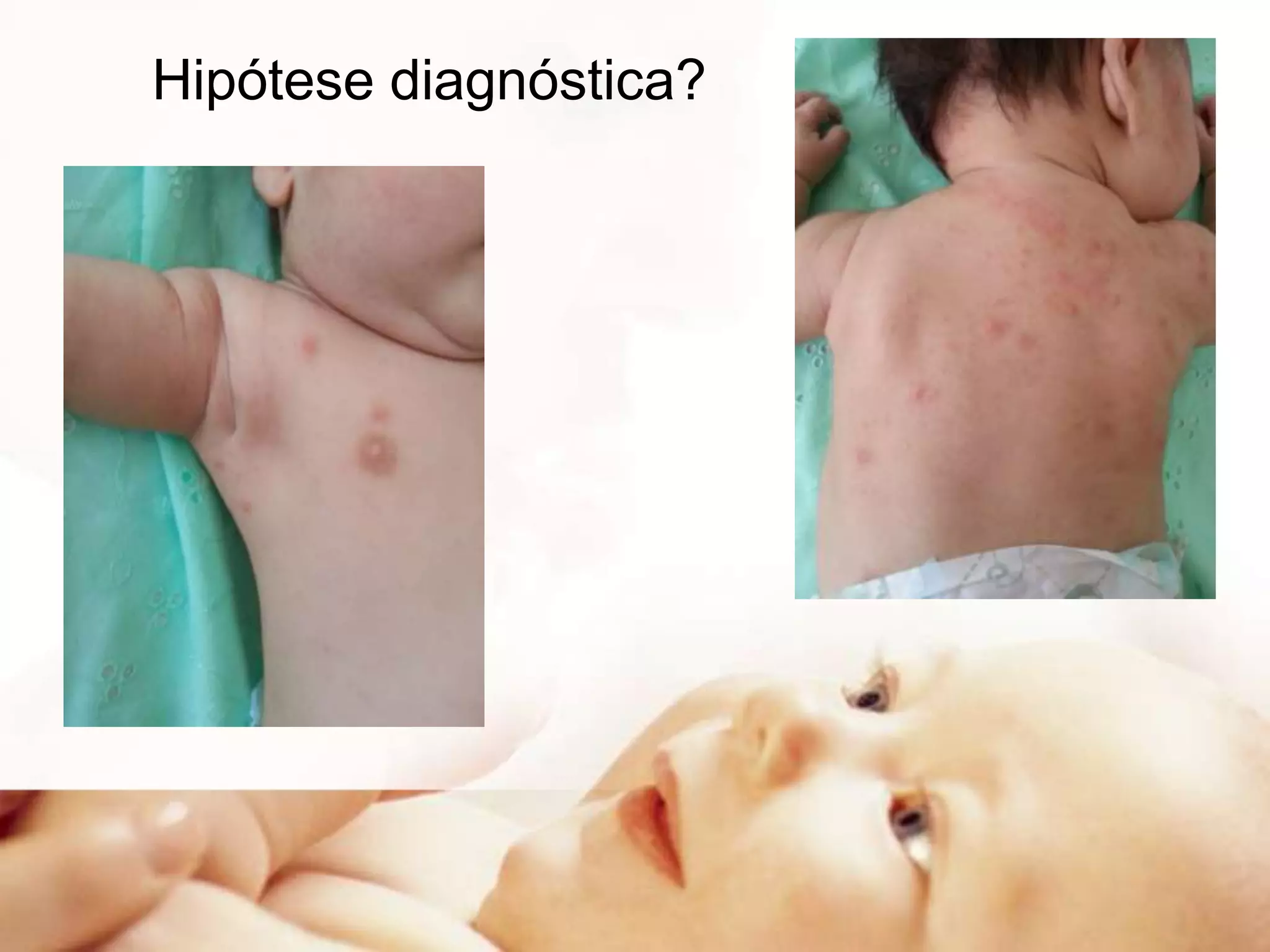 Hipótese diagnóstica?