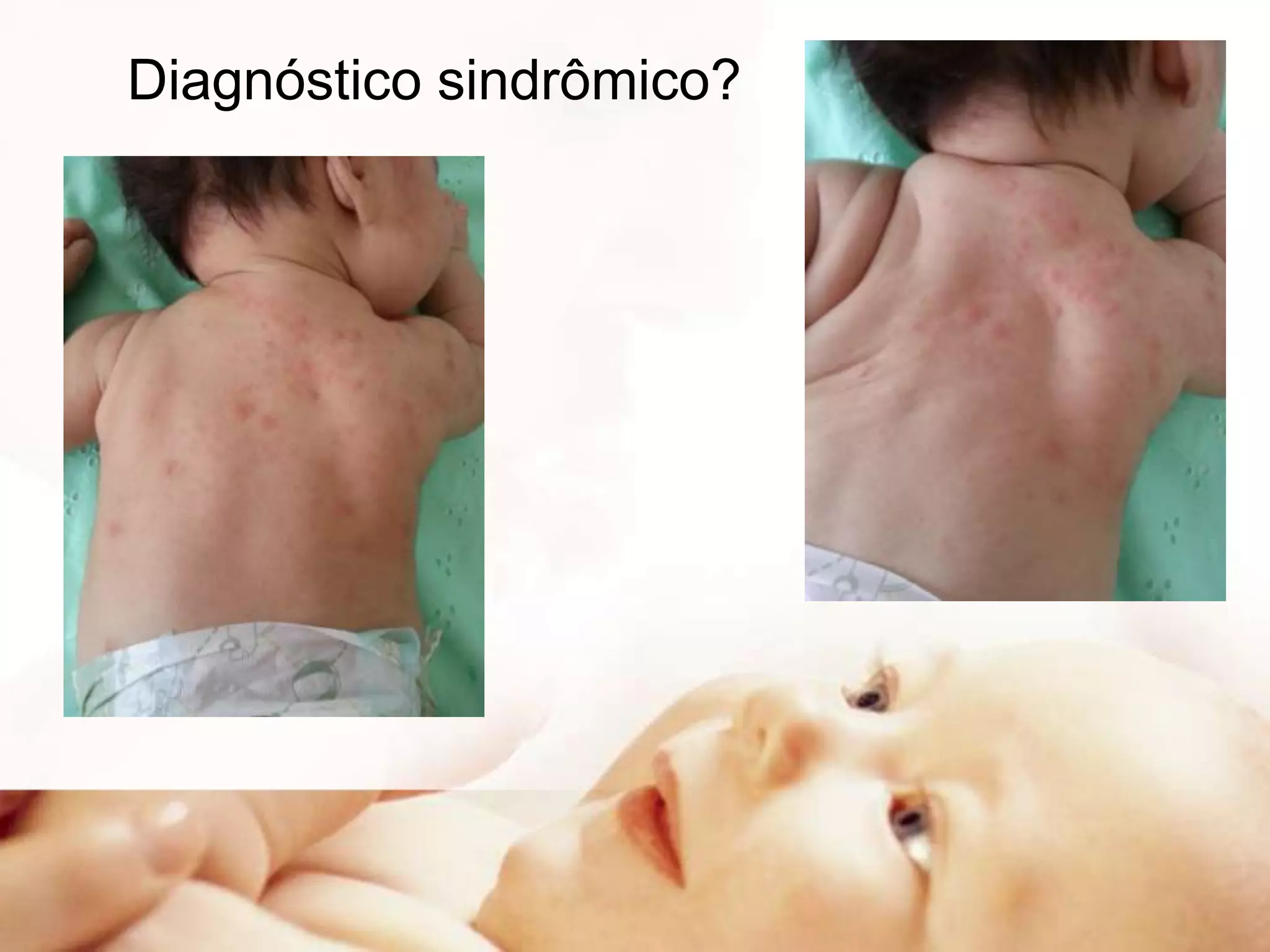 Diagnóstico sindrômico?