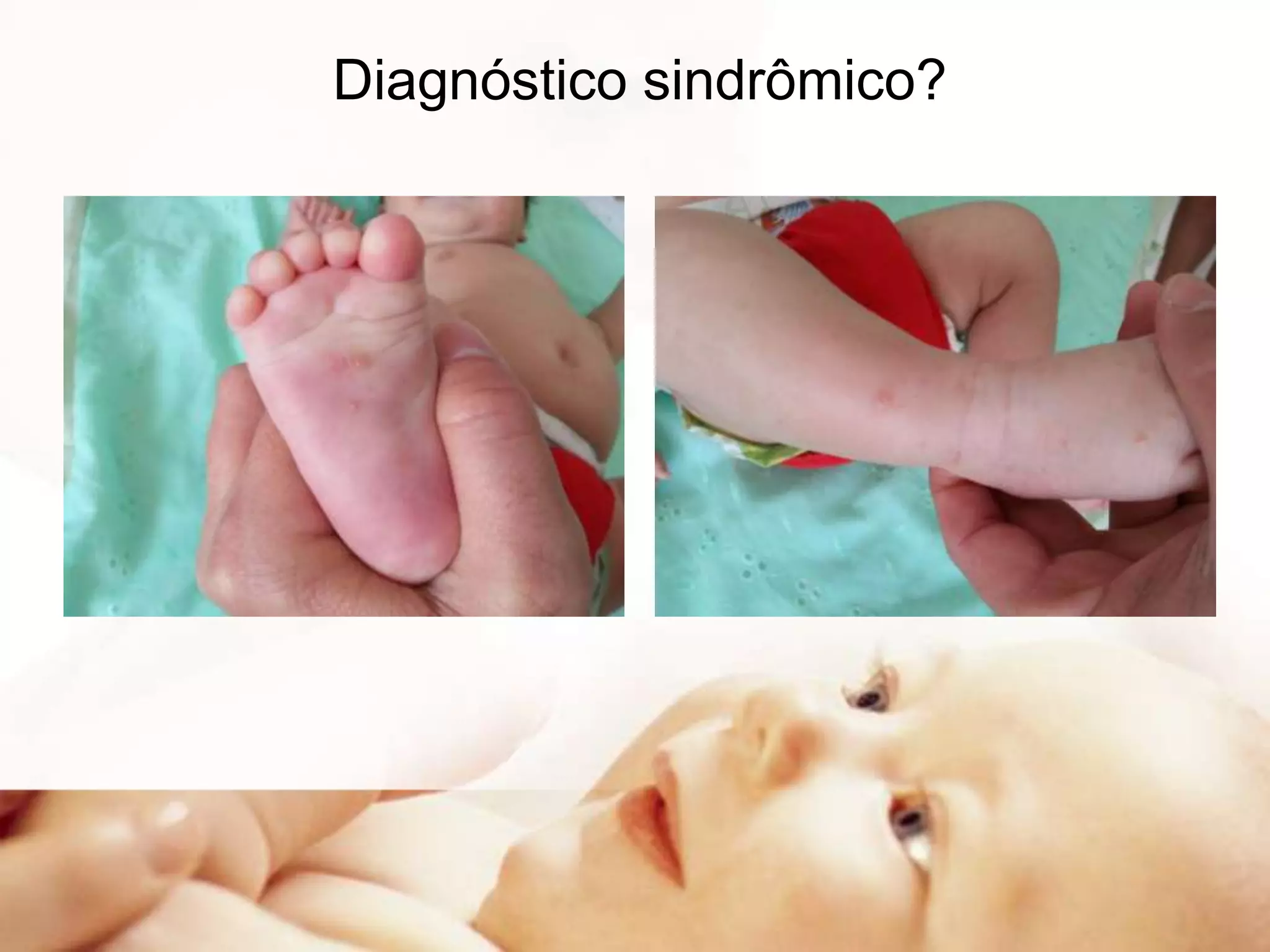 Diagnóstico sindrômico?