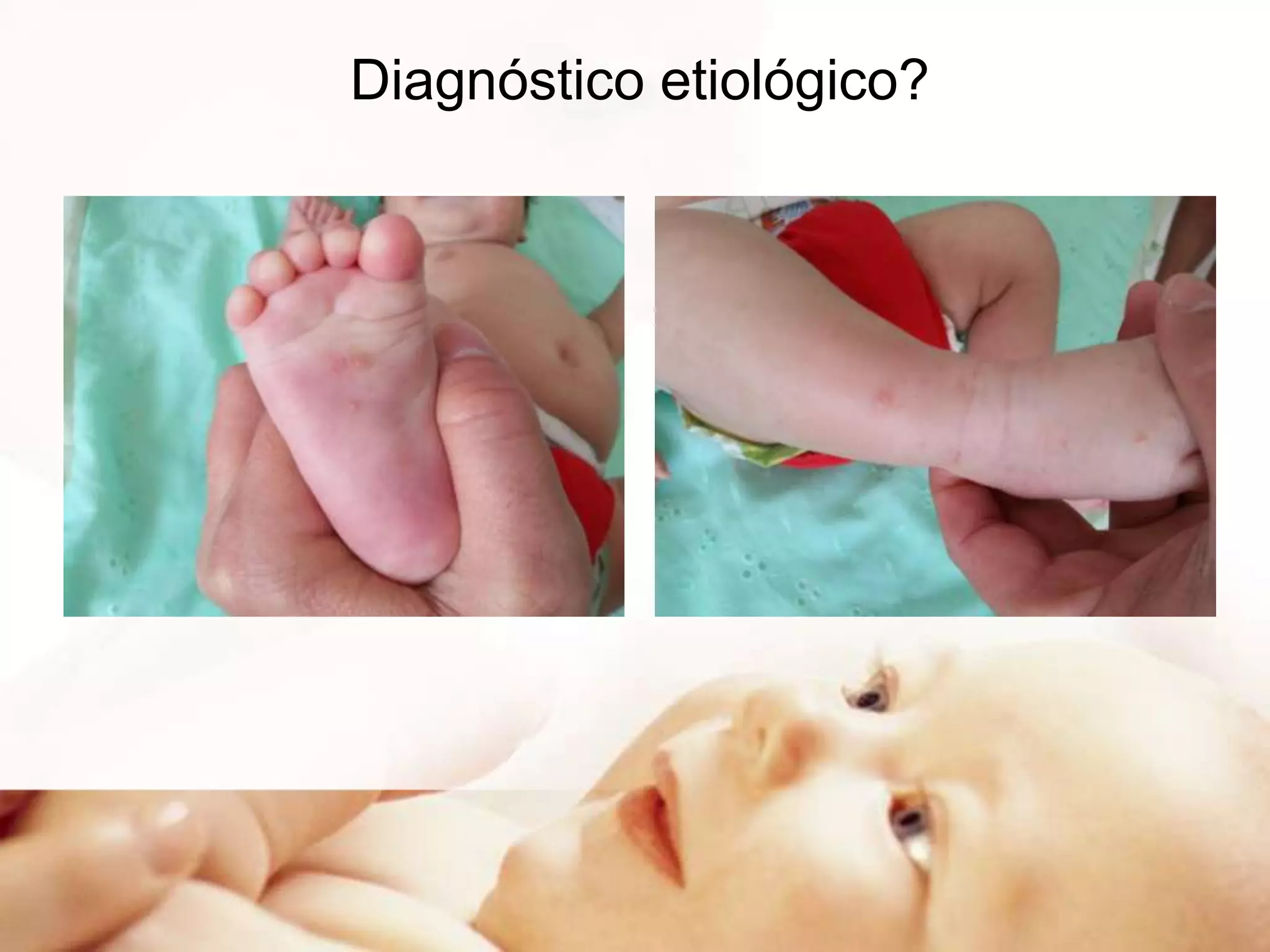 Diagnóstico etiológico?