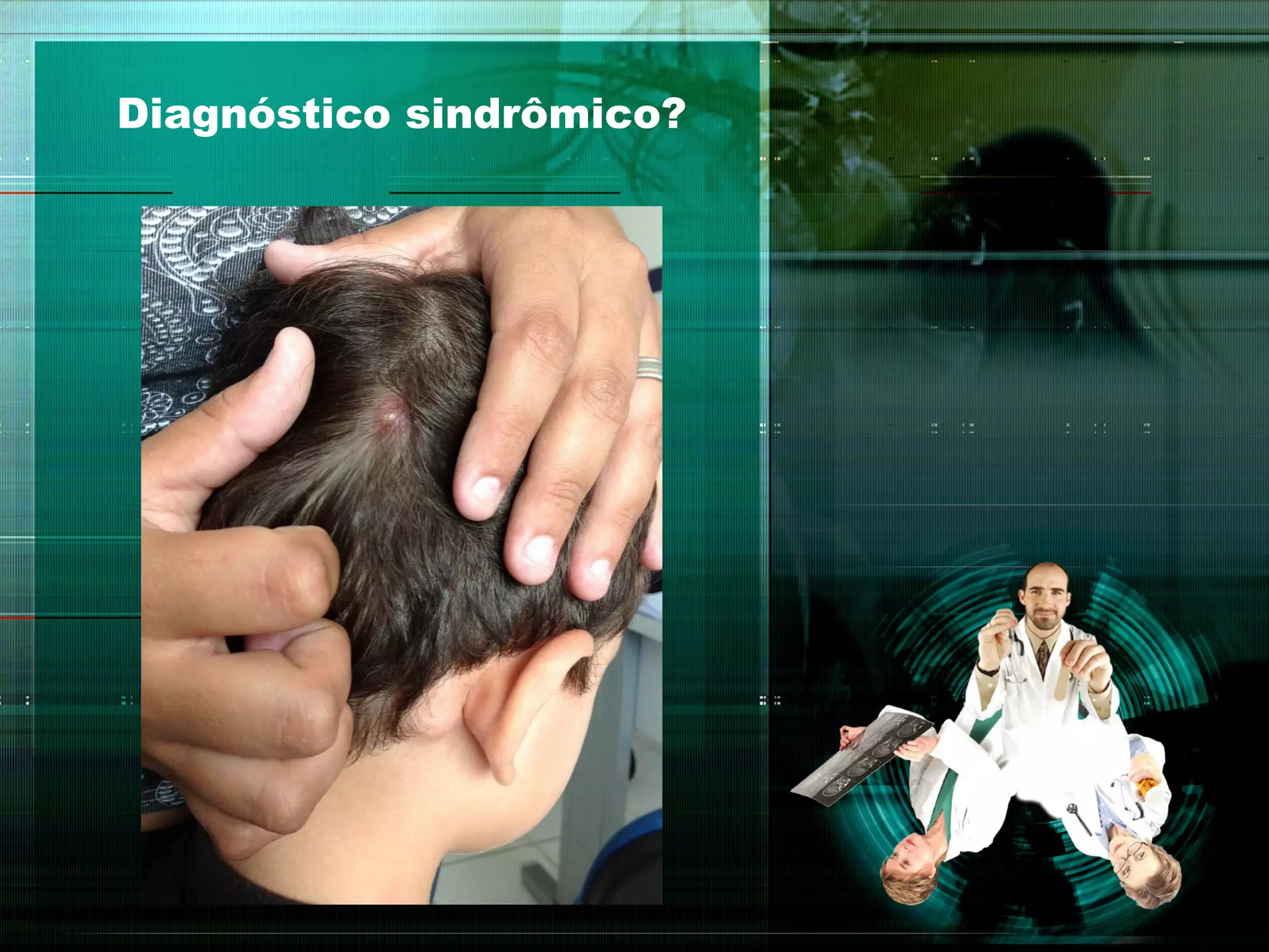 Diagnóstico sindrômico?