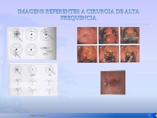 Serviço De Propedêutica Do Colo Aula1