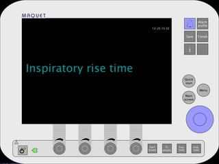 Inspiratory rise time 