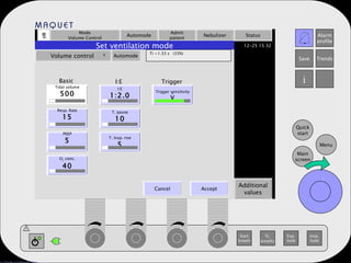Mode Volume Control Automode Admit patient Nebulizer Status Additional values Set ventilation mode Volume control   Automode Ti =1.33 s  (33%) Tidal volume 500 Resp. Rate 15 PEEP 5 O 2  conc. 40 I:E 1:2.0 T. pause 10 T. Insp. rise 5 Trigger sensitivity V Basic I:E Trigger . Cancel Accept . 