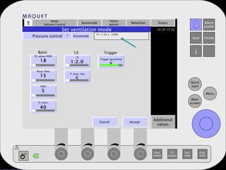Mode Volume Control Automode Admit patient Nebulizer Status Additional values Set ventilation mode Pressure control   Automode Ti =1.33 s  (33%) PC above PEEP 18 Resp. Rate 15 PEEP 5 O 2  conc. 40 I:E 1:2.0 T. Insp. rise 5 Trigger sensitivity V Basic I:E Trigger . Cancel Accept 