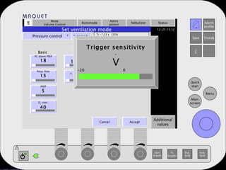 Mode Volume Control Automode Admit patient Nebulizer Status Additional values Set ventilation mode Pressure control   Automode Ti =1.33 s  (33%) PC above PEEP 18 Resp. Rate 15 PEEP 5 O 2  conc. 40 I:E 1:2.0 T. Insp. rise 5 Trigger sensitivity V Basic I:E Trigger . Cancel Accept Trigger sensitivity . V -20  0  