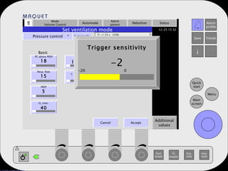 Mode Volume Control Automode Admit patient Nebulizer Status Additional values Set ventilation mode Pressure control   Automode Ti =1.33 s  (33%) PC above PEEP 18 Resp. Rate 15 PEEP 5 O 2  conc. 40 I:E 1:2.0 T. Insp. rise 5 Trigger sensitivity V Basic I:E Trigger . Cancel Accept Trigger sensitivity -2 -20  0  