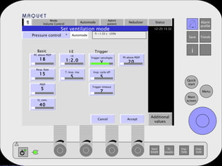 Mode Volume Control Automode Admit patient Nebulizer Status Additional values Set ventilation mode Pressure control   Automode Ti =1.33 s  (33%) PC above PEEP 18 Resp. Rate 15 PEEP 5 O 2  conc. 40 I:E 1:2.0 T. Insp. rise 5 Trigger sensitivity V Basic I:E Trigger . Cancel Accept Insp. cycle off 5 Trigger timeout 7 PS above PEEP 20 