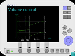 Volume control Time Flow Insp. time Pause time Exp time 