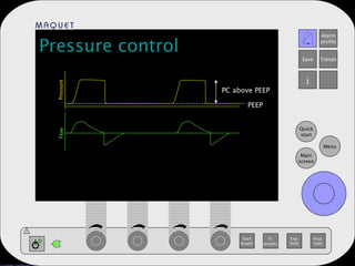 Pressure control PEEP PC above PEEP Pressure Flow 