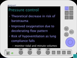 Pressure control Theoretical decrease in risk of barotrauma Improved oxygenation due to decelerating flow pattern Risk of hypoventilation as lung compliance falls monitor tidal and minute volumes 