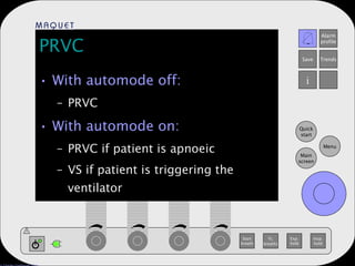 PRVC With automode off: PRVC With automode on: PRVC if patient is apnoeic VS if patient is triggering the ventilator 