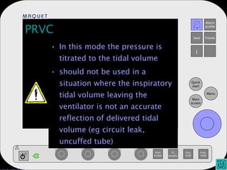 PRVC In this mode the pressure is titrated to the tidal volume should not be used in a situation where the inspiratory tidal volume leaving the ventilator is not an accurate reflection of delivered tidal volume (eg circuit leak, uncuffed tube) 