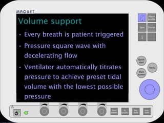 Volume support Every breath is patient triggered Pressure square wave with decelerating flow Ventilator automatically titrates pressure to achieve preset tidal volume with the lowest possible pressure 