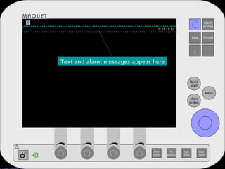 Text and alarm messages appear here 