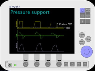 Pressure support PEEP PS above PEEP Pressure Flow Volume 