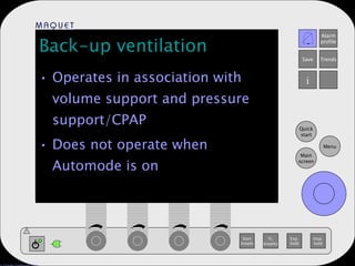 Back-up ventilation Operates in association with volume support and pressure support/CPAP Does not operate when Automode is on 