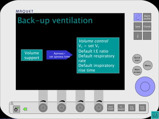 Back-up ventilation Volume support Volume control V T  = set V T Default I:E ratio Default respiratory rate Default inspiratory rise time Apnoea> set apnoea time 