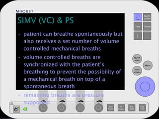patient can breathe spontaneously but also receives a set number of volume controlled mechanical breaths volume controlled breaths are synchronized with the patient’s breathing to prevent the possibility of a mechanical breath on top of a spontaneous breath remaining breaths are pressure supported SIMV (VC) & PS 