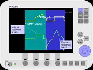 SIMV period Volume controlled breath SIMV cycle Pressure supported breath T T 
