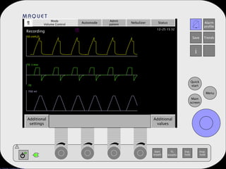 Start breath O 2 breaths Exp. hold Insp. hold Additional settings Additional values Mode Volume Control Automode Admit patient Nebulizer Status 700 ml -70 70  l/min 50 cmH 2 O T Recording 