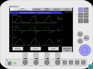 Additional values Mode Volume Control Automode Admit patient Nebulizer Status Recorded waveforms 12/25/02 14:32:10   Settings Cursor Close 50 cmH 2 O -70 70  l/min 700 ml 40 cmH 2 O 0 l/min 475 ml 0.0 s 