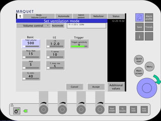 Mode Volume Control Automode Admit patient Nebulizer Status Additional values Set ventilation mode Volume control   Automode Ti =1.33 s  (33%) Tidal volume 500 Resp. Rate 15 PEEP 5 O 2  conc. 40 I:E 1:2.0 T. pause 10 T. Insp. rise 5 Trigger sensitivity V Basic I:E Trigger . Cancel Accept . 