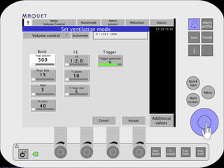 Mode Volume Control Automode Admit patient Nebulizer Status Additional values Set ventilation mode Volume control   Automode Ti =1.33 s  (33%) Tidal volume 500 Resp. Rate 15 PEEP 5 O 2  conc. 40 I:E 1:2.0 T. pause 10 T. Insp. rise 5 Trigger sensitivity V Basic I:E Trigger . Cancel Accept . 