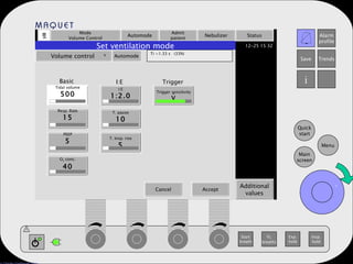 Mode Volume Control Automode Admit patient Nebulizer Status Additional values Set ventilation mode Volume control   Automode Ti =1.33 s  (33%) Tidal volume 500 Resp. Rate 15 PEEP 5 O 2  conc. 40 I:E 1:2.0 T. pause 10 T. Insp. rise 5 Trigger sensitivity V Basic I:E Trigger . Cancel Accept . 