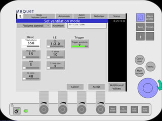 Mode Volume Control Automode Admit patient Nebulizer Status Additional values Set ventilation mode Volume control   Automode Ti =1.33 s  (33%) Tidal volume 550 Resp. Rate 15 PEEP 5 O 2  conc. 40 I:E 1:2.0 T. pause 10 T. Insp. rise 5 Trigger sensitivity V Basic I:E Trigger . Cancel Accept . 