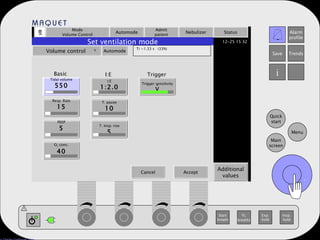 Mode Volume Control Automode Admit patient Nebulizer Status Additional values Set ventilation mode Volume control   Automode Ti =1.33 s  (33%) Tidal volume 550 Resp. Rate 15 PEEP 5 O 2  conc. 40 I:E 1:2.0 T. pause 10 T. Insp. rise 5 Trigger sensitivity V Basic I:E Trigger . Cancel Accept . 