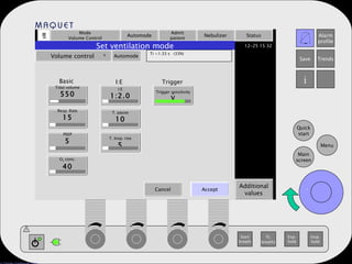 Mode Volume Control Automode Admit patient Nebulizer Status Additional values Set ventilation mode Volume control   Automode Ti =1.33 s  (33%) Tidal volume 550 Resp. Rate 15 PEEP 5 O 2  conc. 40 I:E 1:2.0 T. pause 10 T. Insp. rise 5 Trigger sensitivity V Basic I:E Trigger . Cancel Accept . 