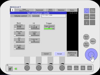 Mode Volume Control Automode Admit patient Nebulizer Status Additional values Set ventilation mode Volume control   Automode Ti =1.33 s  (33%) Tidal volume 550 Resp. Rate 15 PEEP 5 O 2  conc. 40 I:E 1:2.0 T. pause 10 T. Insp. rise 5 Trigger sensitivity V Basic I:E Trigger . Cancel Accept . 
