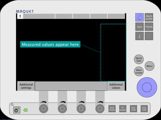Measured values appear here Start breath O 2 breaths Exp. hold Insp. hold Main screen Menu Quick start Alarm profile Save Trends i Additional settings Additional values ! 