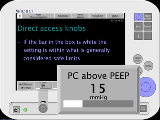 Direct access knobs If the bar in the box is white the setting is within what is generally considered safe limits Mode Pressure Control Automode Admit patient Nebulizer Status Additional settings Additional values PEEP 5 Resp. rate 15 Tidal volume 500 ml b/min % cm H 2 O mmHg O 2  conc. 30 PC above PEEP 15 