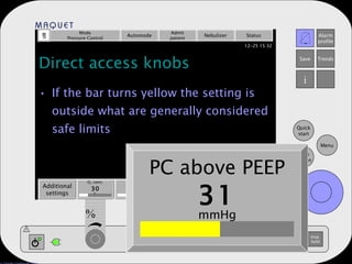 Direct access knobs If the bar turns yellow the setting is outside what are generally considered safe limits Mode Pressure Control Automode Admit patient Nebulizer Status Additional settings Additional values PEEP 5 Resp. rate 15 Tidal volume 500 ml b/min % cm H 2 O % mmHg O 2  conc. 30 PC above PEEP 31 