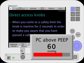 Direct access knobs When you come to a safety limit the knob is inactive for 2 seconds in order to make you aware that you have passed a safety limit Mode Pressure Control Automode Admit patient Nebulizer Status Additional settings Additional values PEEP 5 Resp. rate 15 Tidal volume 500 ml b/min % cm H 2 O % mmHg O 2  conc. 30 PC above PEEP 60 
