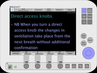 Direct access knobs NB When you turn a direct access knob the changes in ventilation take place from the next breath without additional confirmation Mode Pressure Control Automode Admit patient Nebulizer Status Additional settings Additional values O 2  conc. 30 PEEP 5 Resp. rate 15 PC above PEEP 15 mmHg b/min % cm H 2 O 