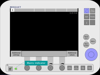 Start breath O 2 breaths Exp. hold Insp. hold Main screen Menu Quick start Alarm profile Save Trends i Additional settings Additional values ! Mains indicator 