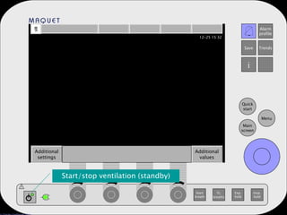 Start breath O 2 breaths Exp. hold Insp. hold Main screen Menu Quick start Alarm profile Save Trends i Additional settings Additional values ! Start/stop ventilation (standby) 