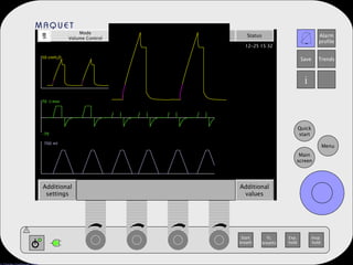 Start breath O 2 breaths Exp. hold Insp. hold Additional settings Additional values Mode Volume Control Automode Admit patient Nebulizer Status T 700 ml -70 70  l/min 50 cmH 2 O 