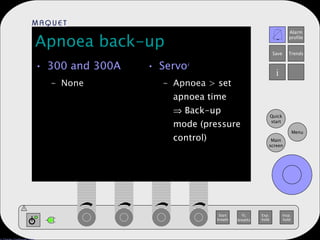 Apnoea back-up 300 and 300A None Servo i Apnoea >  set apnoea time   Back-up mode (pressure control) 