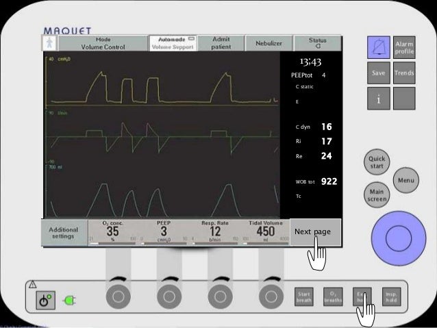 Servoi Mechanical Ventilation